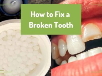 How to Fix a Broken Tooth